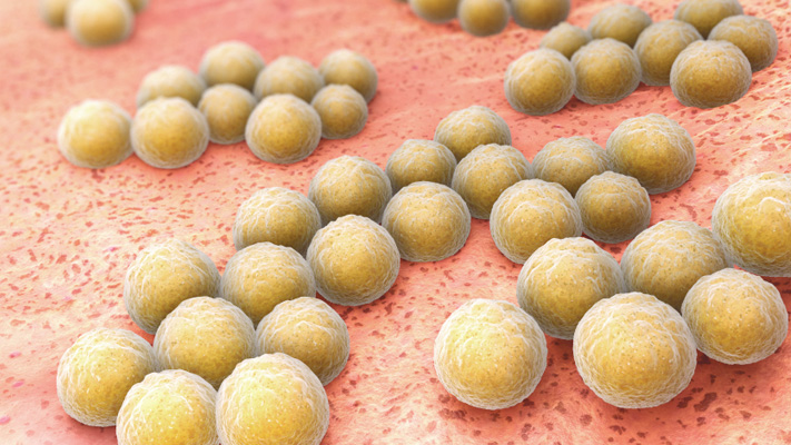 Kháng sinh và hiện tượng kháng ngược của “siêu vi khuẩn” tụ cầu vàng kháng methicillin (MRSA)