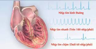 Các bệnh tim mạch thường gặp ở trẻ em
