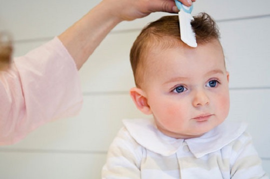Rụng tóc ở trẻ em có đáng lo?