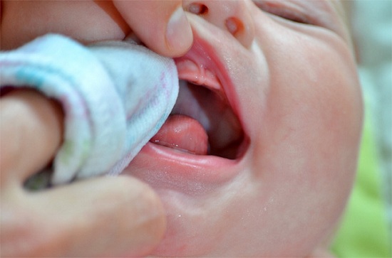 Chăm sóc răng miệng cho trẻ mới mọc răng