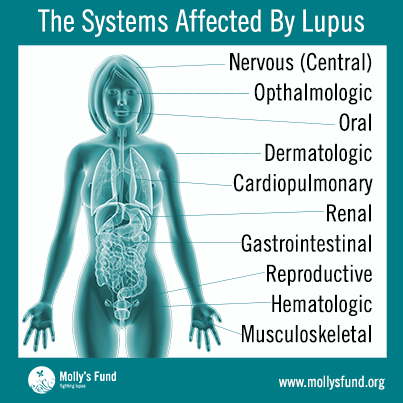 Những ảnh hưởng của Lupus ban đỏ hệ thống lên cơ thể