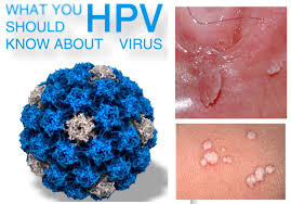 Những điều cần biết về nhiễm HPV ở nam giới
