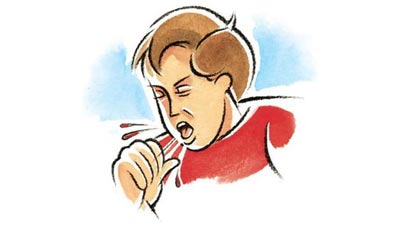 6 dấu hiệu ung thư vòm họng dễ bị bỏ qua