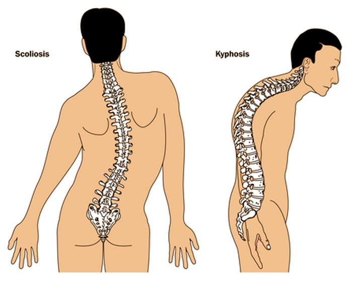 8 bệnh thường đi kèm với chứng đau lưng