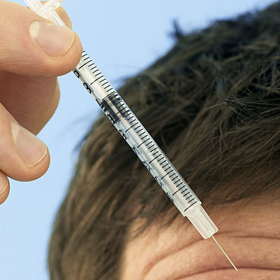 13 phương pháp trị đau đầu không dùng thuốc