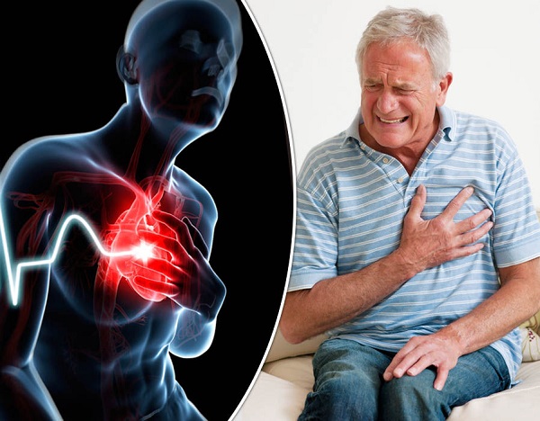 Những cơn đau ngực dễ bị nhầm với cơn nhồi máu cơ tim