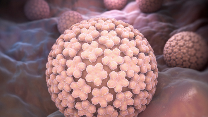 HPV có gây vô sinh không?