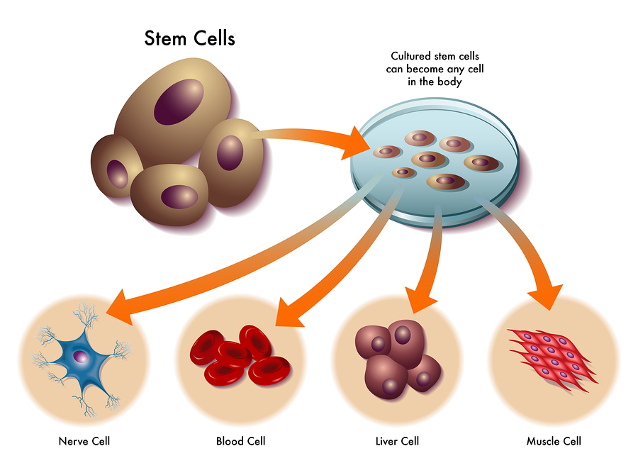 Điều trị viêm khớp bằng tế bào gốc: lợi ích-nguy cơ?