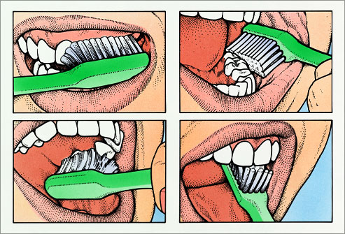 Tiểu đường và các vấn đề răng miệng