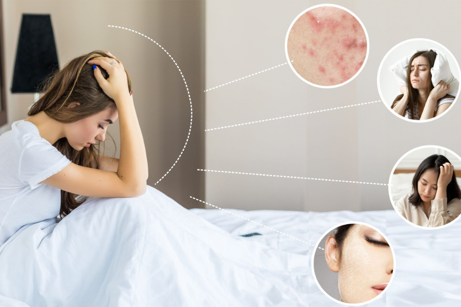 Rối loạn nội tiết tố nữ khiến chu kỳ kinh nguyệt và tâm lý thay đổi thế nào? | VIAM clinic