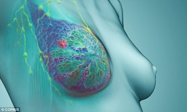 Nghiên cứu mới: Ung thư vú giai đoạn cuối có thể bị xóa