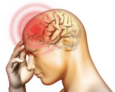 Hội chứng màng não là gì