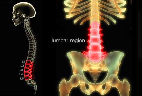 Tổng hợp phương pháp điều trị và phòng bệnh đau lưng