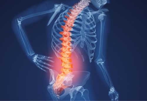 Bệnh đau lưng – Nguyên nhân do đâu?