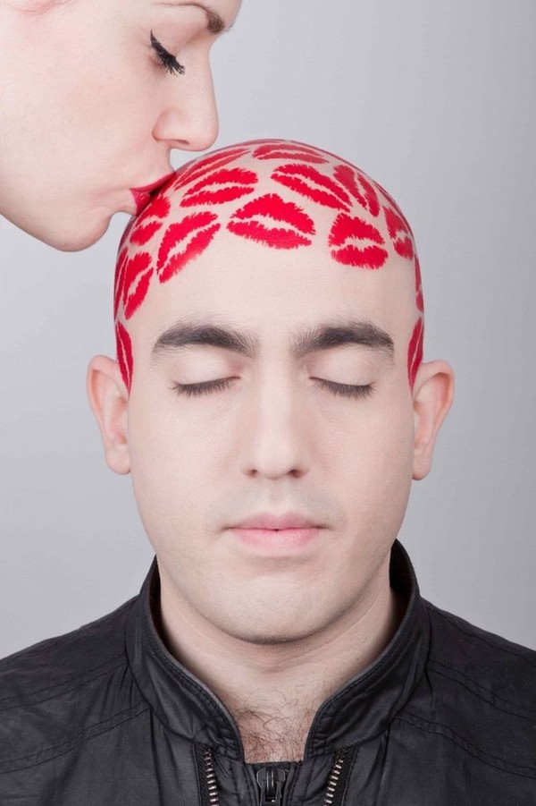 Phát hiện tế bào giúp chữa bệnh hói đầu trong cơ thể