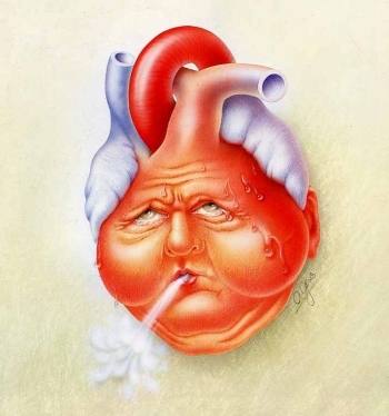 Sự khác nhau giữa nhồi máu cơ tim và suy tim