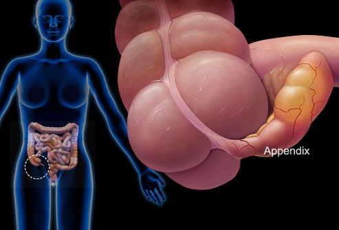 Những nguyên nhân hàng đầu gây đau bụng dưới ở phụ nữ