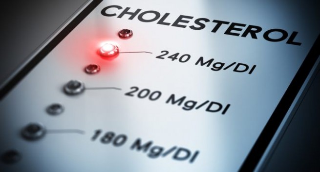 Cholesterol cao: Coi chừng mất mạng!