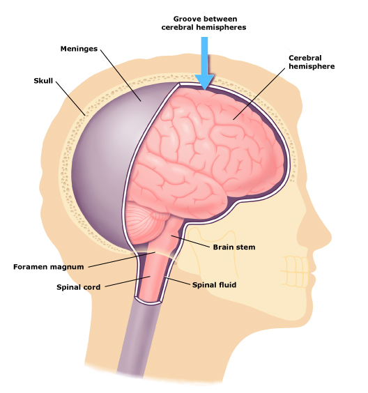 U màng não: chẩn đoán, nguy cơ và phân loại