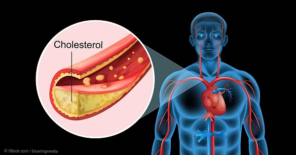 Hiến máu giúp giảm cholesterol?