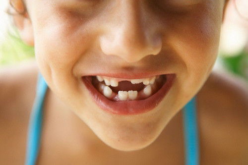 Khi nào trẻ sẽ thay răng sữa?