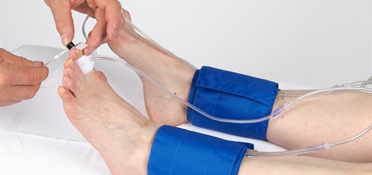 Chỉ số huyết áp cổ chân- cánh tay ABI
