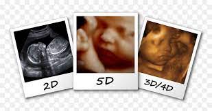 Chẩn đoán sớm siêu âm 4d và 5d để phát hiện các vấn đề sức khỏe thai nhi
