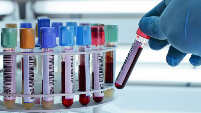 Hướng dẫn cách đọc kết quả xét nghiệm máu | VIAM